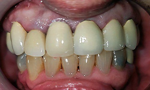 case studies -  Dentist Lancaster CA