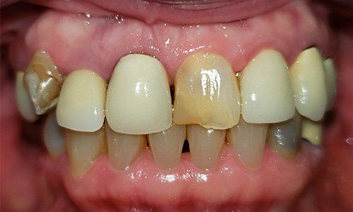 case studies -  Dentist Lancaster CA