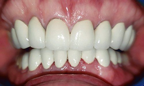 Cowns - Dentist Lancaster CA