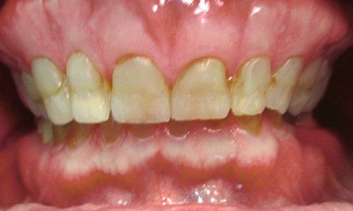 Cowns - Dentist Lancaster CA